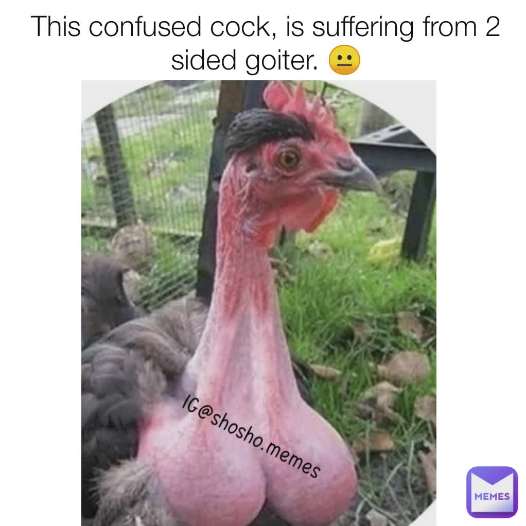 IG@shosho.memes  IG@shosho.memes  This confused cock, is suffering from 2 sided goiter. 😐